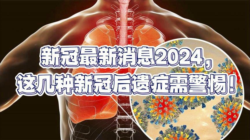 新冠病毒2024年最新消息,数据驱动执行设计_HDR版54.391